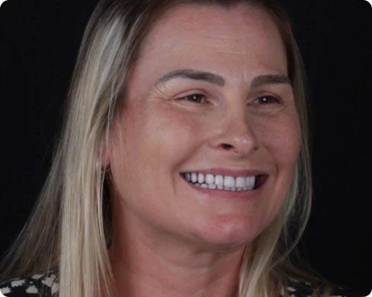 Paciente sorrindo após tratamento odontológico na Clínica OdontoQuality em Tijucas.